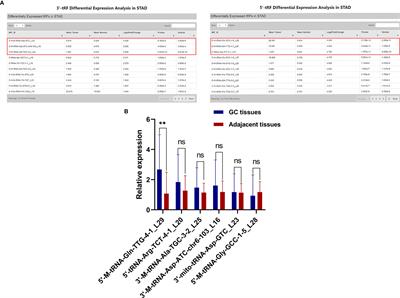 Serum hsa_tsr016141 as a Kind of tRNA-Derived Fragments Is a Novel Biomarker in Gastric Cancer